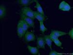 ANKRD27 Antibody in Immunocytochemistry (ICC/IF)