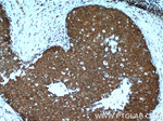 ANKRD27 Antibody in Immunohistochemistry (Paraffin) (IHC (P))