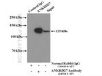 ANKRD27 Antibody in Immunoprecipitation (IP)