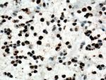 PCNA Antibody in Immunohistochemistry (Paraffin) (IHC (P))