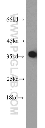 PCNA Antibody in Western Blot (WB)