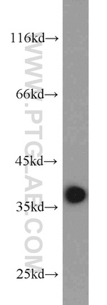 PCNA Antibody in Western Blot (WB)