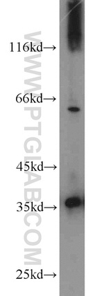 PCNA Antibody in Western Blot (WB)