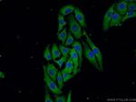 ZDHHC9 Antibody in Immunocytochemistry (ICC/IF)