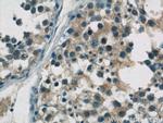 ZDHHC9 Antibody in Immunohistochemistry (Paraffin) (IHC (P))