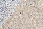 ZDHHC9 Antibody in Immunohistochemistry (Paraffin) (IHC (P))