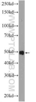 ZDHHC9 Antibody in Western Blot (WB)