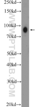 Glucocorticoid receptor Antibody in Western Blot (WB)