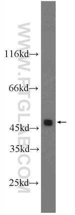 DR4 Antibody in Western Blot (WB)