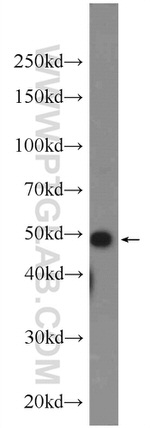 DR4 Antibody in Western Blot (WB)