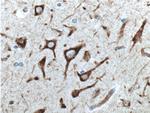 NHEDC2 Antibody in Immunohistochemistry (Paraffin) (IHC (P))