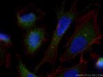 CEP120 Antibody in Immunocytochemistry (ICC/IF)