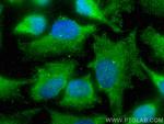 CEP120 Antibody in Immunocytochemistry (ICC/IF)