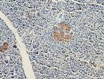 CEP120 Antibody in Immunohistochemistry (Paraffin) (IHC (P))