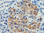 CEP120 Antibody in Immunohistochemistry (Paraffin) (IHC (P))