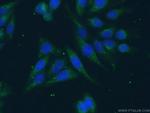 Rac1 Antibody in Immunocytochemistry (ICC/IF)