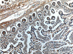 Rac1 Antibody in Immunohistochemistry (Paraffin) (IHC (P))