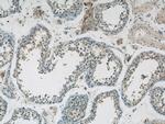 SPRED2 Antibody in Immunohistochemistry (Paraffin) (IHC (P))