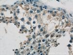 SPRED2 Antibody in Immunohistochemistry (Paraffin) (IHC (P))