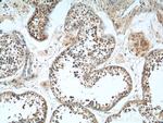 MAGEF1 Antibody in Immunohistochemistry (Paraffin) (IHC (P))