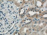 Cd2ap Antibody in Immunohistochemistry (Paraffin) (IHC (P))