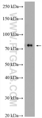 Cd2ap Antibody in Western Blot (WB)