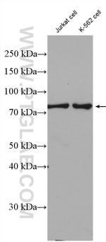 Cd2ap Antibody in Western Blot (WB)