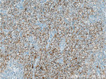 SOD2 Antibody in Immunohistochemistry (Paraffin) (IHC (P))