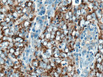 SOD2 Antibody in Immunohistochemistry (Paraffin) (IHC (P))