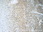 SOD2 Antibody in Immunohistochemistry (Paraffin) (IHC (P))