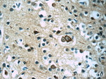 SOD2 Antibody in Immunohistochemistry (Paraffin) (IHC (P))