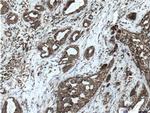 SOD2 Antibody in Immunohistochemistry (Paraffin) (IHC (P))