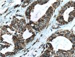 SOD2 Antibody in Immunohistochemistry (Paraffin) (IHC (P))