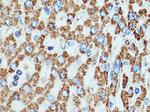 SOD2 Antibody in Immunohistochemistry (Paraffin) (IHC (P))