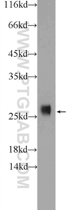 SOD2 Antibody in Western Blot (WB)