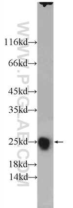 SOD2 Antibody in Western Blot (WB)