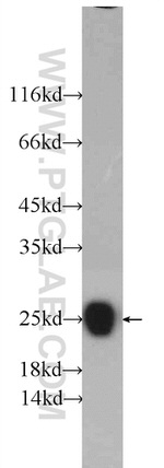 SOD2 Antibody in Western Blot (WB)