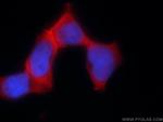 PSMC3 Antibody in Immunocytochemistry (ICC/IF)