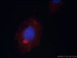 PSMC3 Antibody in Immunocytochemistry (ICC/IF)