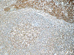 PSMC3 Antibody in Immunohistochemistry (Paraffin) (IHC (P))