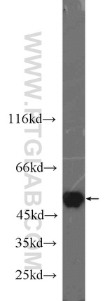 PSMC3 Antibody in Western Blot (WB)