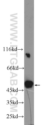 PSMC3 Antibody in Western Blot (WB)