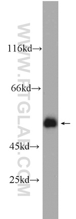 PSMC3 Antibody in Western Blot (WB)