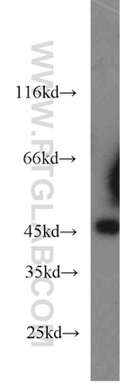 JNK Antibody in Western Blot (WB)