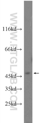 JNK Antibody in Western Blot (WB)