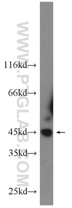 JNK Antibody in Western Blot (WB)