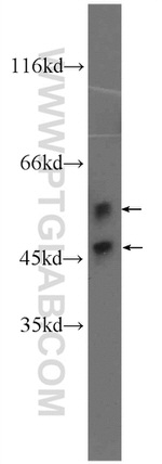 JNK Antibody in Western Blot (WB)