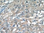 JNK Antibody in Immunohistochemistry (Paraffin) (IHC (P))