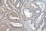 JNK Antibody in Immunohistochemistry (Paraffin) (IHC (P))