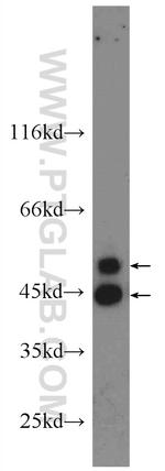 JNK Antibody in Western Blot (WB)